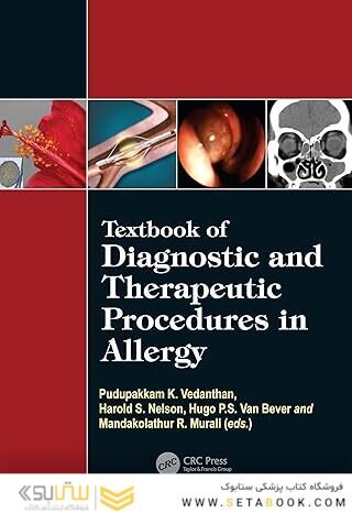 Textbook of Diagnostic and Therapeutic Procedures in Allergy 1st Edition