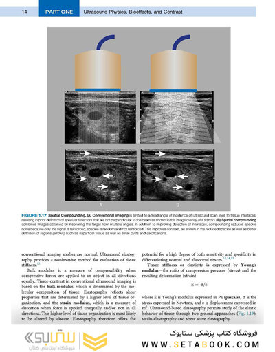 Diagnostic Ultrasound, Set 6th Edition 2024