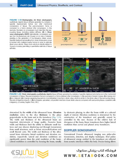 Diagnostic Ultrasound, Set 6th Edition 2024
