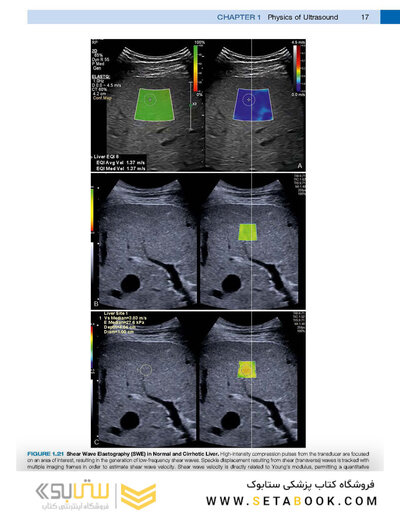 Diagnostic Ultrasound, Set 6th Edition 2024