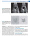 Diagnostic Ultrasound, Set 6th Edition 2024