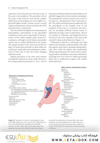 Cardiac Pacing and ICDs
