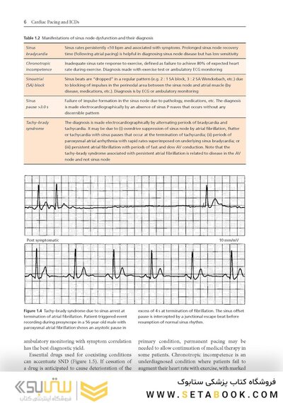 Cardiac Pacing and ICDs