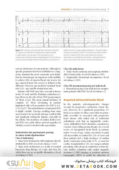 Cardiac Pacing and ICDs