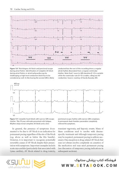 Cardiac Pacing and ICDs