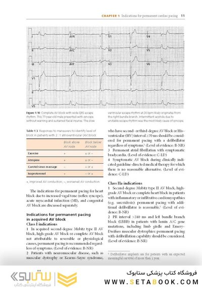 Cardiac Pacing and ICDs