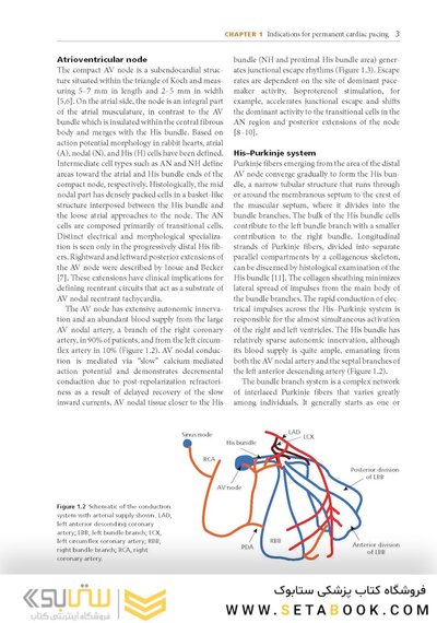 Cardiac Pacing and ICDs