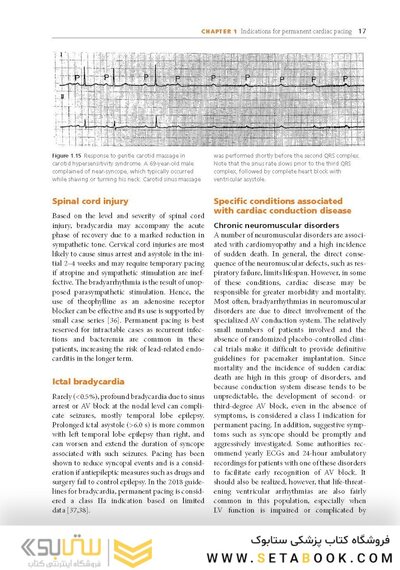 Cardiac Pacing and ICDs