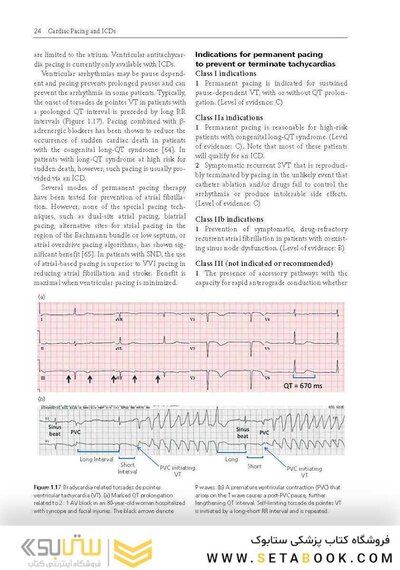 Cardiac Pacing and ICDs