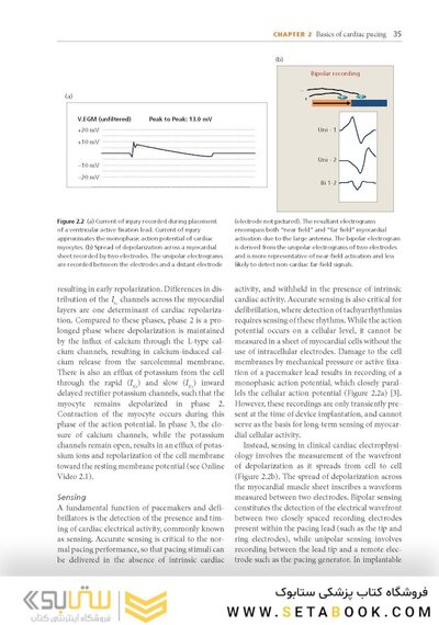 Cardiac Pacing and ICDs