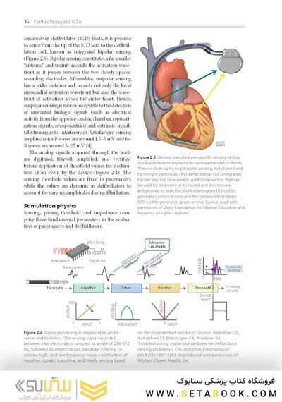 Cardiac Pacing and ICDs