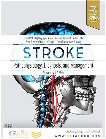 Stroke: Pathophysiology, Diagnosis, and Management 7th Edition