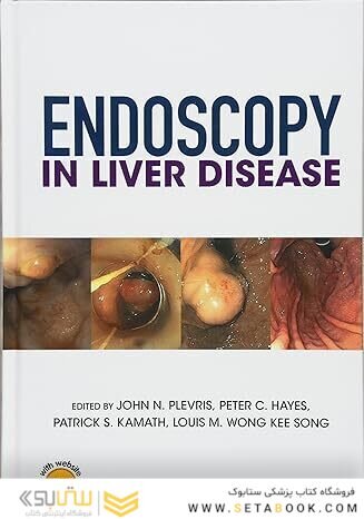 Endoscopy in Liver Disease 1st Edition