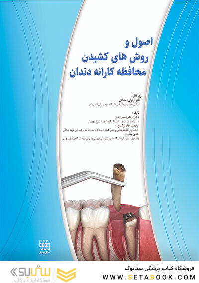 اصول و روش های کشیدن محافظه کارانه دندان