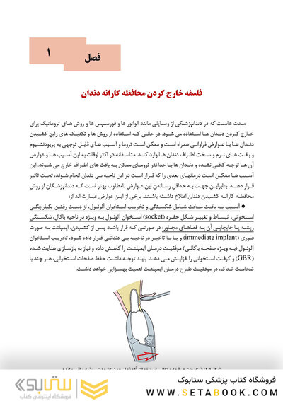 اصول و روش های کشیدن محافظه کارانه دندان