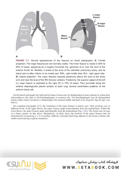Webb & Higgins Thoracic Imaging