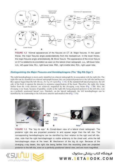 Webb & Higgins Thoracic Imaging