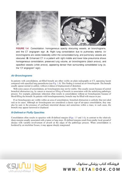 Webb & Higgins Thoracic Imaging