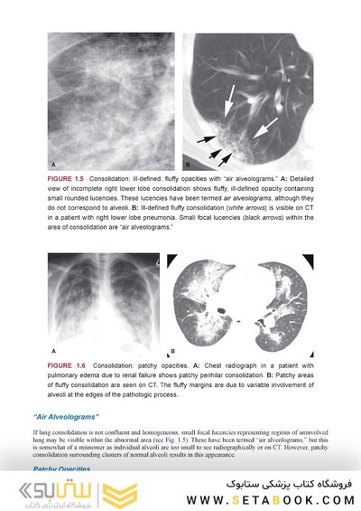 Webb & Higgins Thoracic Imaging