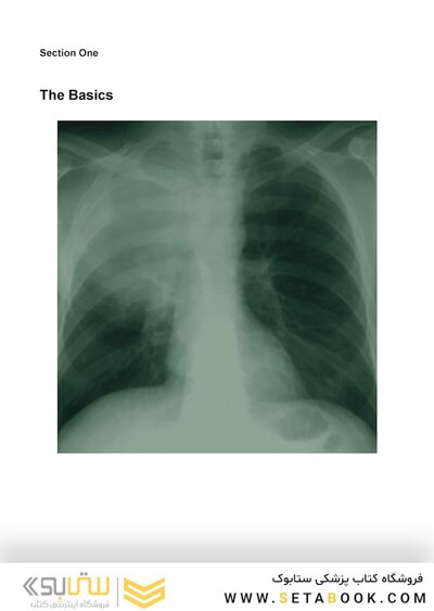 Webb & Higgins Thoracic Imaging