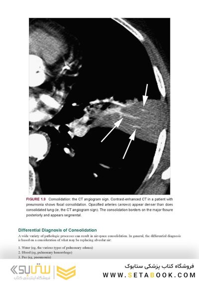 Webb & Higgins Thoracic Imaging