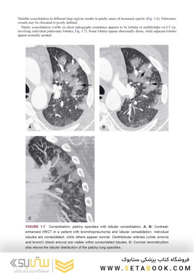 Webb & Higgins Thoracic Imaging