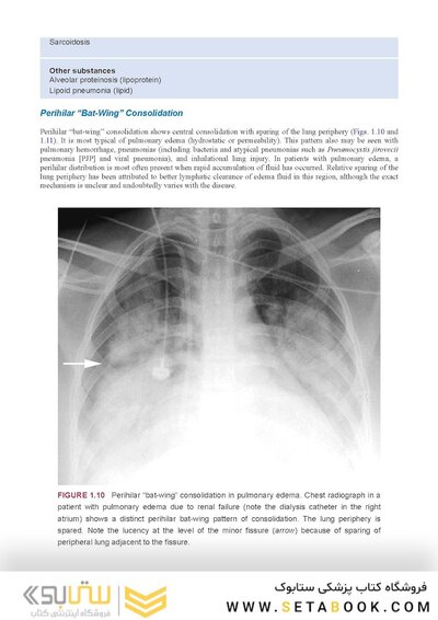Webb & Higgins Thoracic Imaging