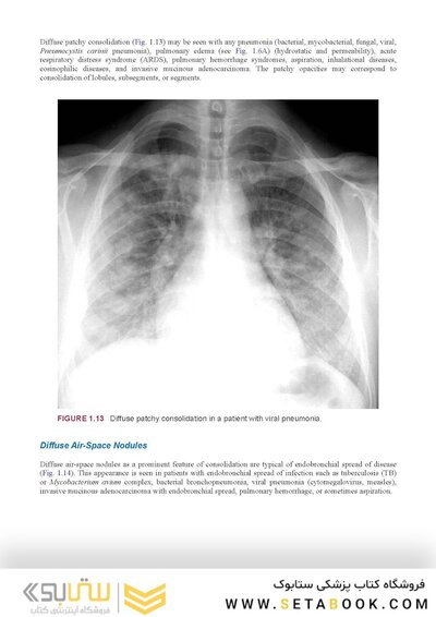 Webb & Higgins Thoracic Imaging