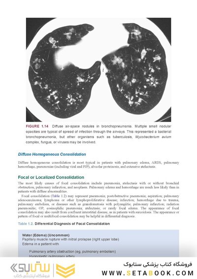 Webb & Higgins Thoracic Imaging