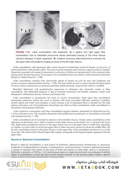 Webb & Higgins Thoracic Imaging