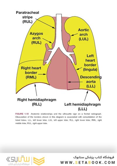 Webb & Higgins Thoracic Imaging
