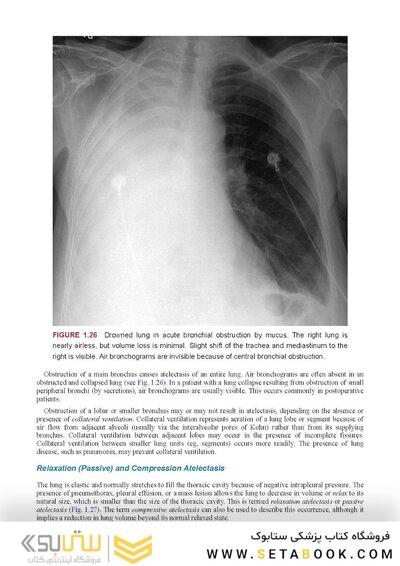 Webb & Higgins Thoracic Imaging