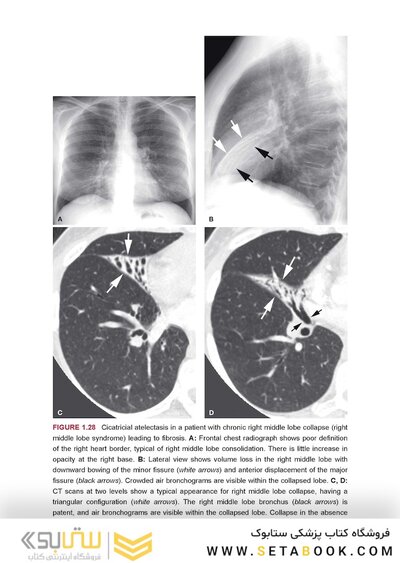 Webb & Higgins Thoracic Imaging