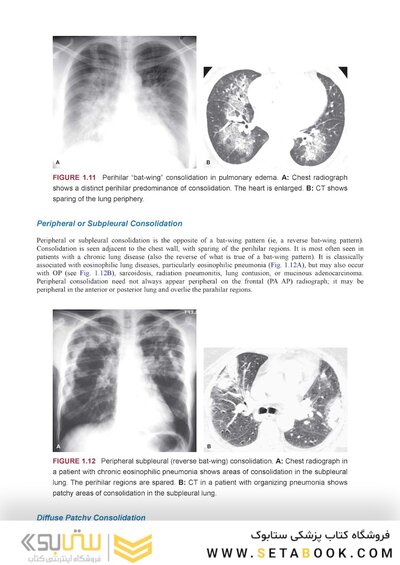 Webb & Higgins Thoracic Imaging
