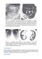 Webb & Higgins Thoracic Imaging