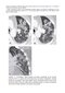 Webb & Higgins Thoracic Imaging