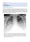Webb & Higgins Thoracic Imaging