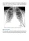 Webb & Higgins Thoracic Imaging