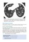 Webb & Higgins Thoracic Imaging