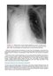 Webb & Higgins Thoracic Imaging