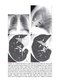 Webb & Higgins Thoracic Imaging