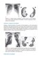 Webb & Higgins Thoracic Imaging