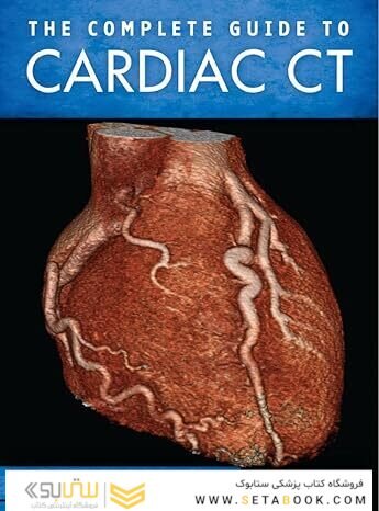The Complete Guide to Cardiac CT 1st Edition