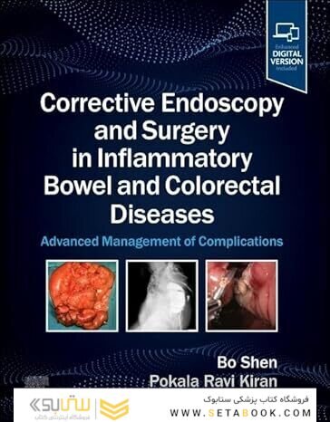 Corrective Endoscopy and Surgery in Inflammatory Bowel and Colorectal Diseases: Advanced Management of Complications