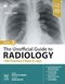 The Unofficial Guide to Radiology: 100 Practice Chest X-rays 2nd Edition