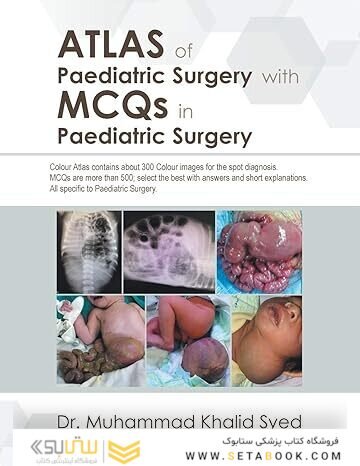 Atlas of Paediatric Surgery with Mcqs in Paediatric Surgery