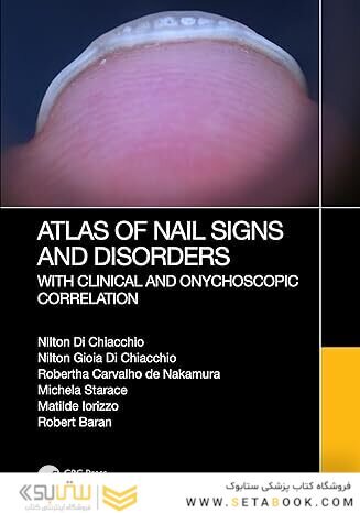 Atlas of Nail Signs and Disorders with Clinical and Onychoscopic Correlation 1st Edition