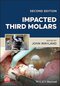 Impacted Third Molars 2nd Edition