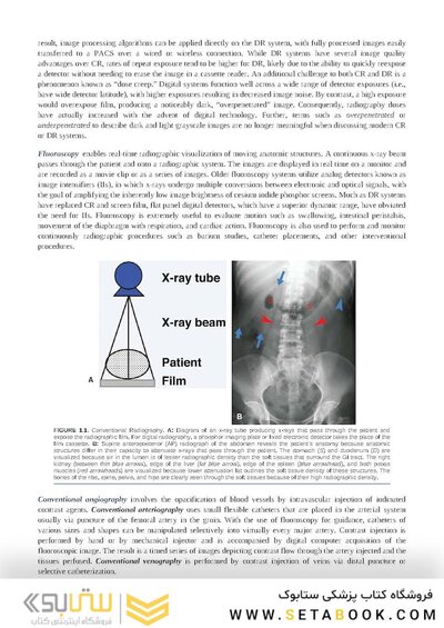 Brant & Helms' Fundamentals of Diagnostic Radiology:  Sixth Edition