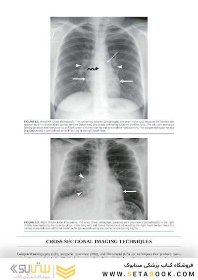 Brant & Helms' Fundamentals of Diagnostic Radiology:  Sixth Edition
